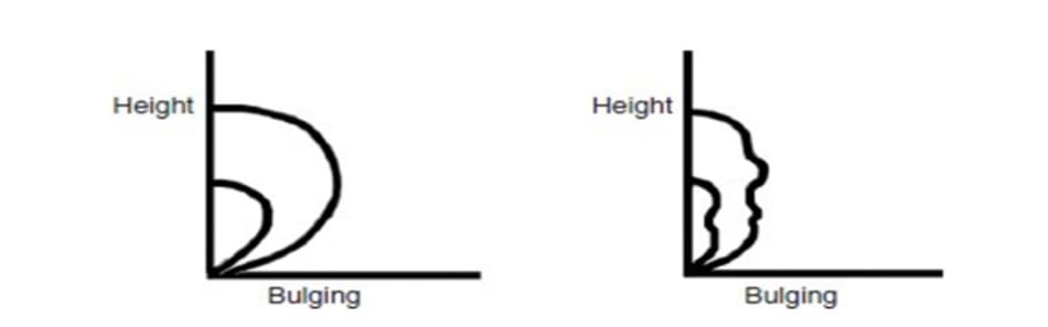 Hình 9-10 Khi tăng chiều cao của nếp trên bệnh nhân trẻ, hiệu ứng trồi sẽ tăng gấp đôi (hình bên trái). Độ dầy trước sụn mi không gây chú ý đối với lớp da mỏng, nhăn của bệnh nhân lớn tuổi. Tăng chiều cao nếp không ảnh hưởng độ trồi (hình bên phải).