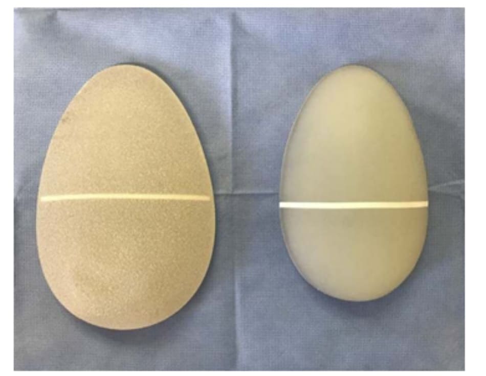 Hình. 17. Khối implant silicone (bên trái) và elastomer (bên phải) với một vạch trắng ở giữa để giúp Bác sĩ có thể định vị chúng khi phẫu thuật.